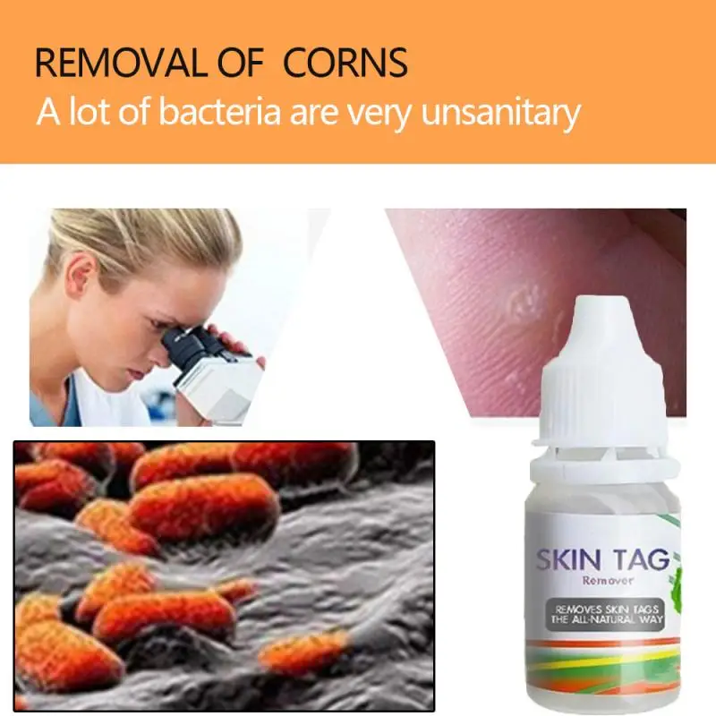 1 шт. Машинка для удаления магнитных бирок инструмент мокротов на ногах бородавок