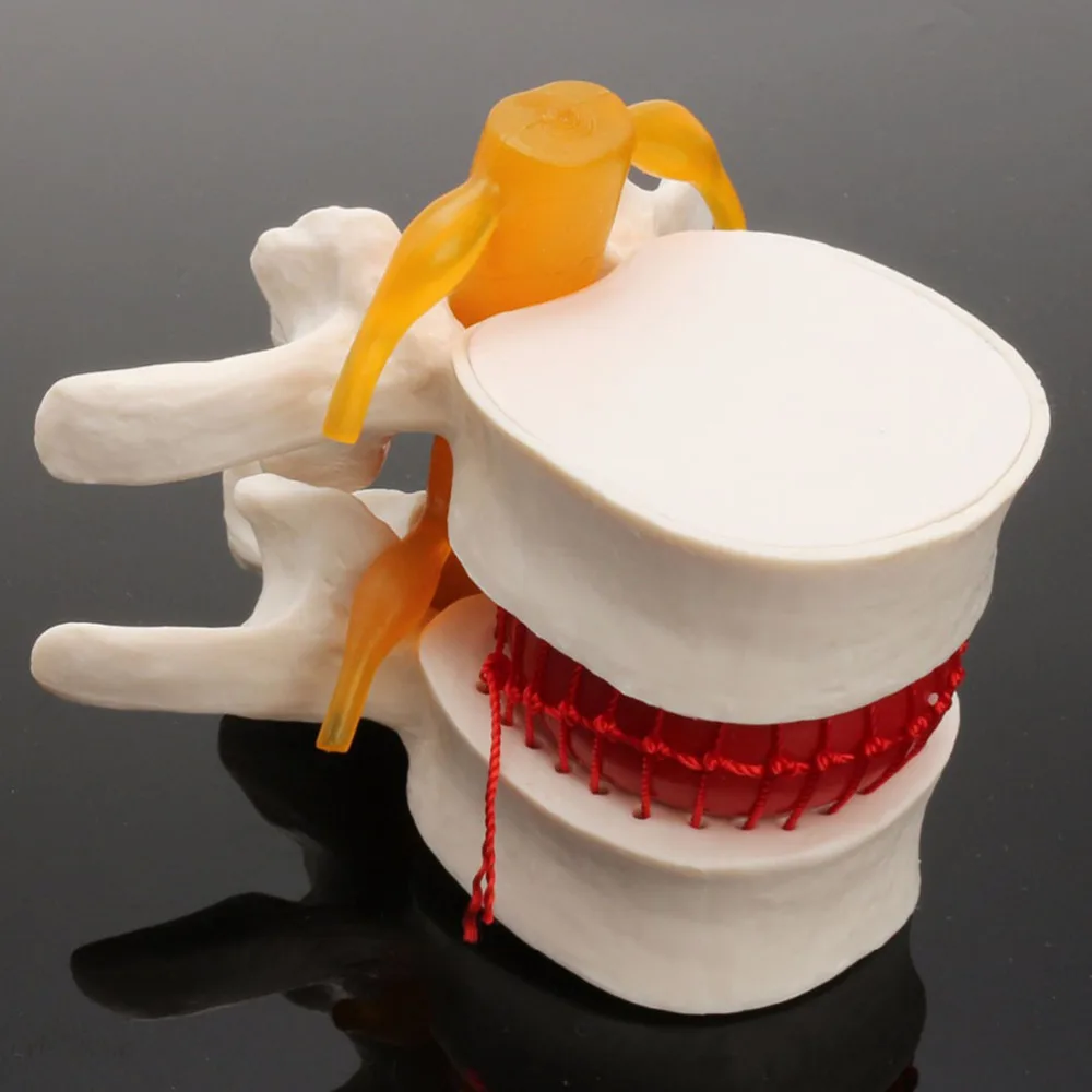 

1pc Spine Anatomy Model Lumbar Vertebral Column Model Enlargement Lumbar Model
