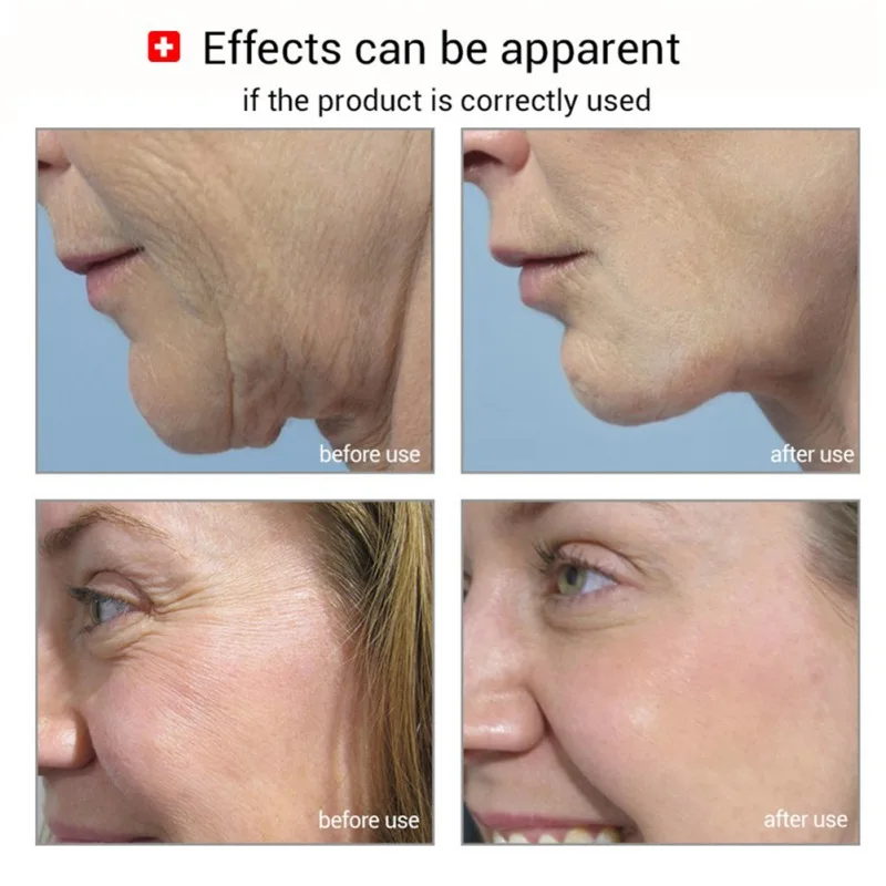 Удаление желтых грязевых масел примесей для всех типов кожи глубокое очищение