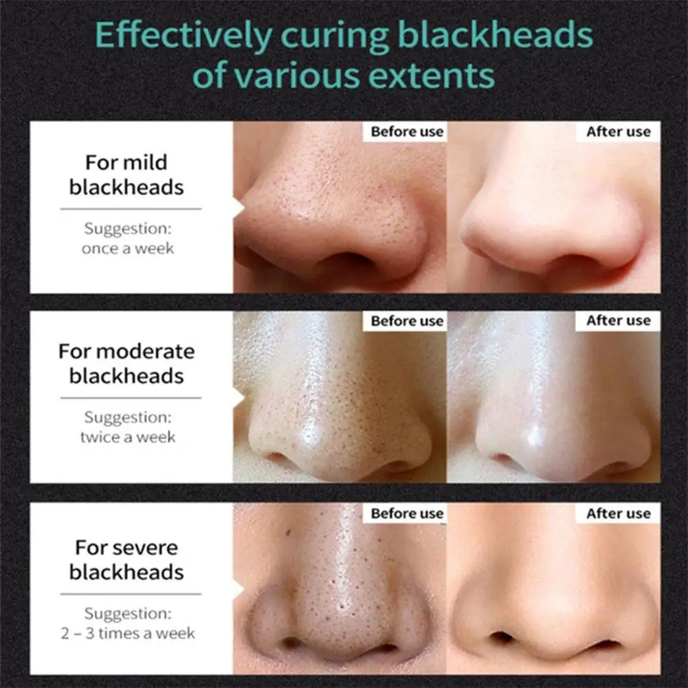 

50ml Blackhead Remover Nose Black Mask Face Care Mud Peel Cleaning Shrink Control Care Mask Oil Treatment Skin Acne Pores M D4E0