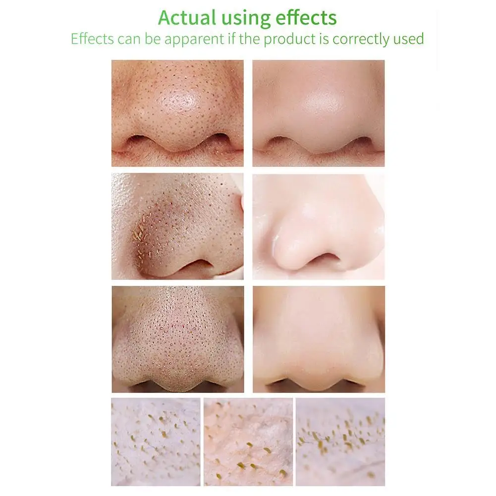 

Aloe Vera 17ml To Blackhead Acne Nasal Liquid Sodium Hyaluronate Shrinking Pore Essence To Relieve Dryness And Repair Skin Damag