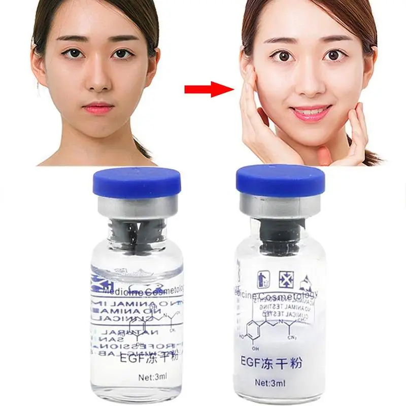 1 комплект сыворотка для устранения морщин и акне|Сыворотка| |