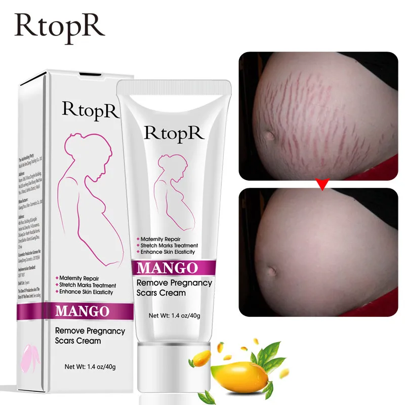 

RtopR Mango Pregnancy Scars Removal Cream Stretch Marks Treatment Anti-Aging Anti Winkles Pigment Correction Firming Body Cream