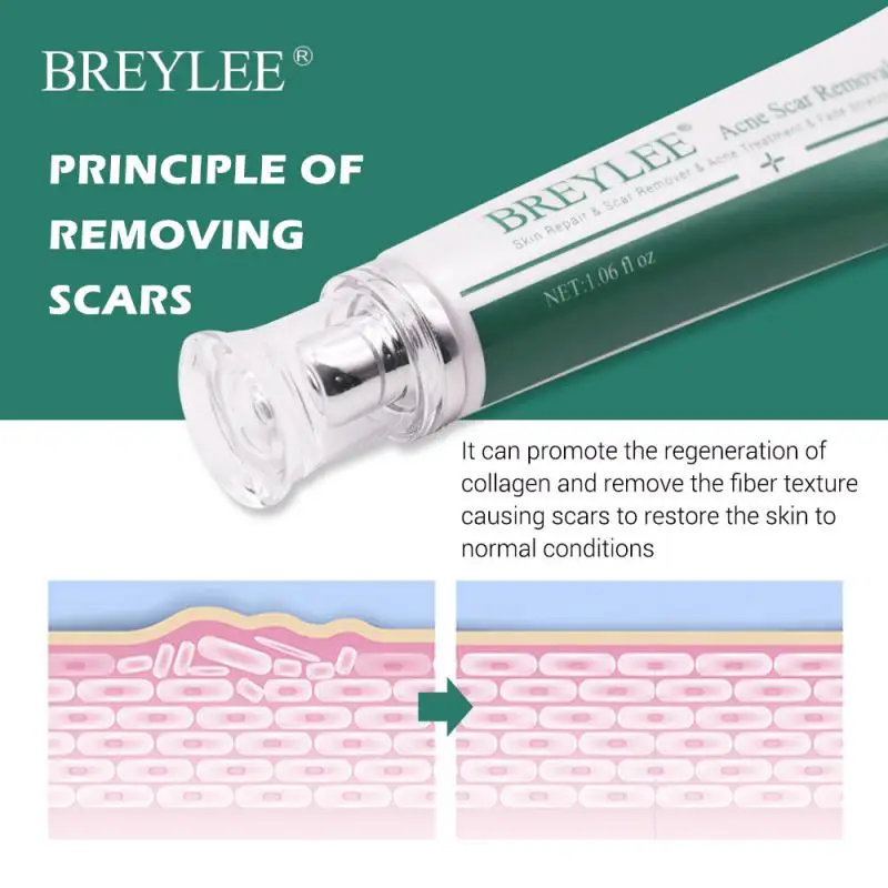 

Desalting and repairing scar cream Repair Scar Removal Cream Acne Scars Stretch Marks Cream Scar Burn For Pigmentation
