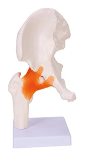 Hip joint model human skeleton model hip joint with ligament model femoral head joint model