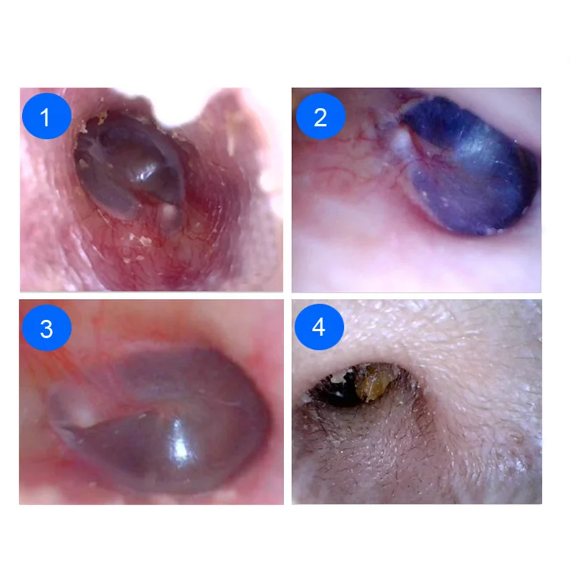 Ложка уха очистители копания цифровой Видимый инструмент Нержавеющая сталь