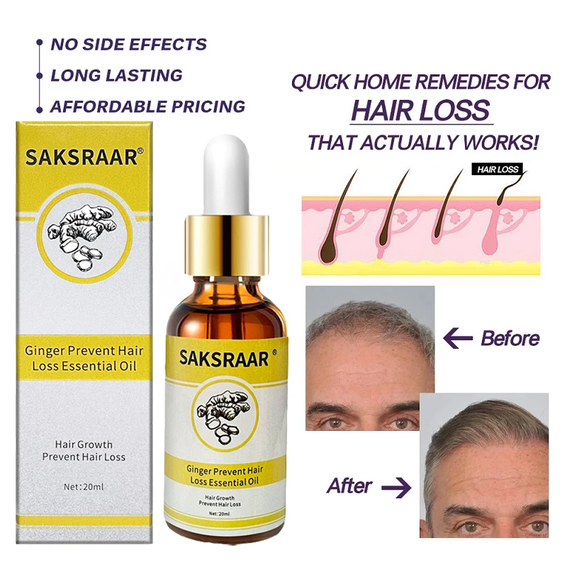 Уход За Волосами Эфирные масла для роста волос экстракт оригинальный