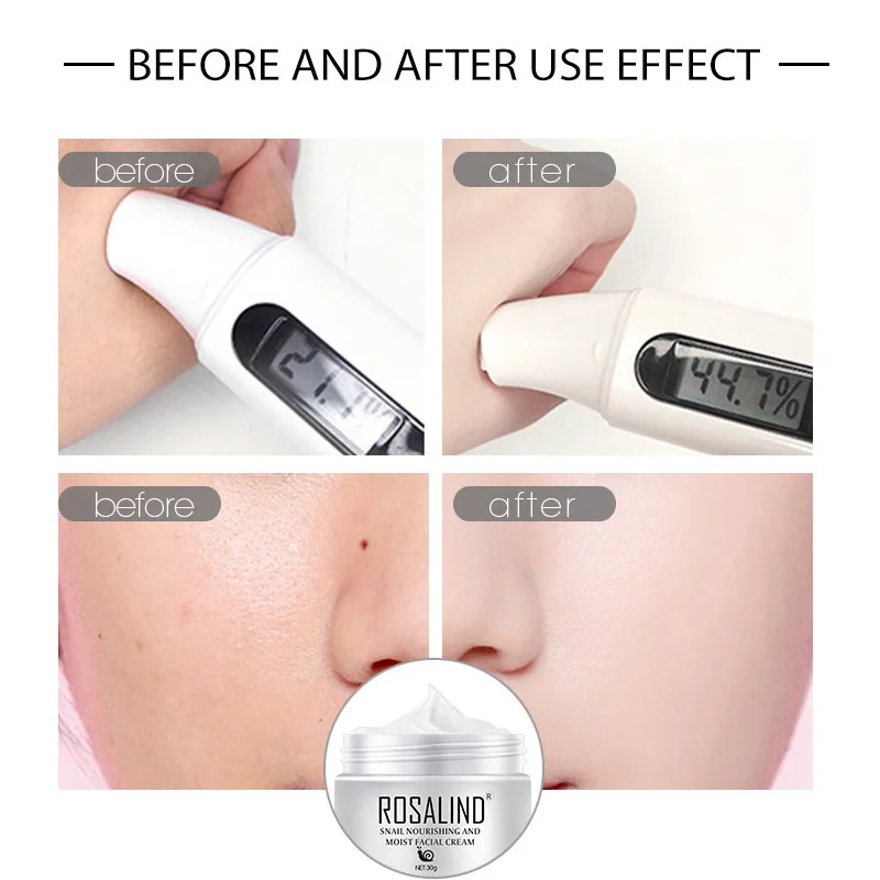 Улиточный крем увлажняет восполняет чистый анти чувствительный QRD88| |