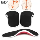 Ортопедические стельки, 3d-стельки с супинатором для коррекции плоскостопия, для мужчин и женщин, от боли в ступнях, унисекс, Прямая поставка