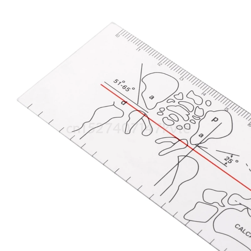 Пластиковый Гониометр угловая медицинская линейка инструменты для