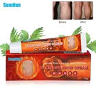 1 шт., крем для лечения варикозного расширения вен