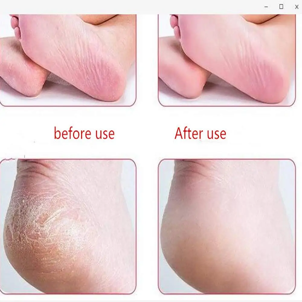 Рашпиль для ног и удаление мозолей двусторонние скрабы скребок ухода за ногами