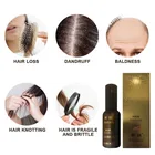 Сыворотка для роста волос, 30 мл, Имбирная сыворотка, лечение против выпадения, Глубокое восстановление, повреждение корней волос, масло для ухода за волосами и кожей головы TSLM3