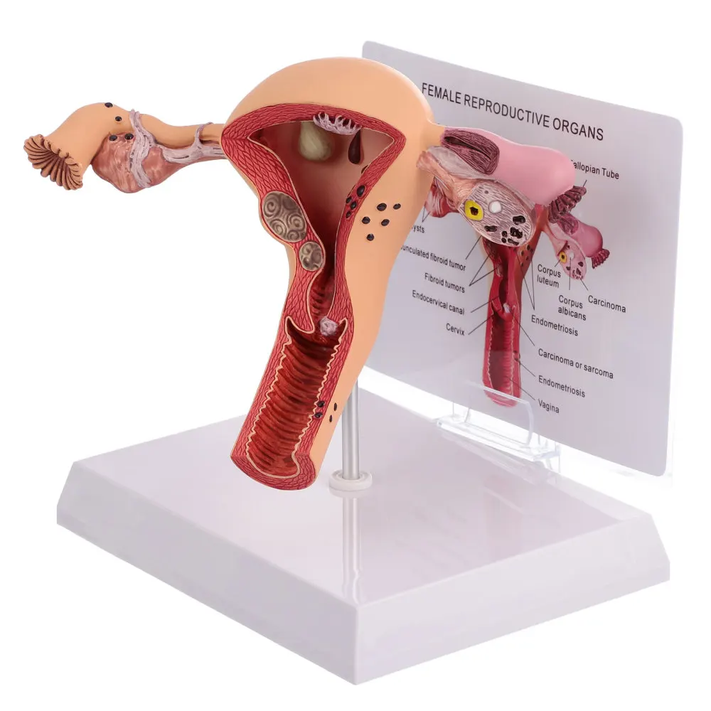 

1Pc Female Internal Reproductive Anatomical Model Human Anatomy Model