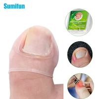 1pairbox ingrown toe nail correction sticker patch paronychia invisible nail acronyx orthotics patch foot care treatment c1951