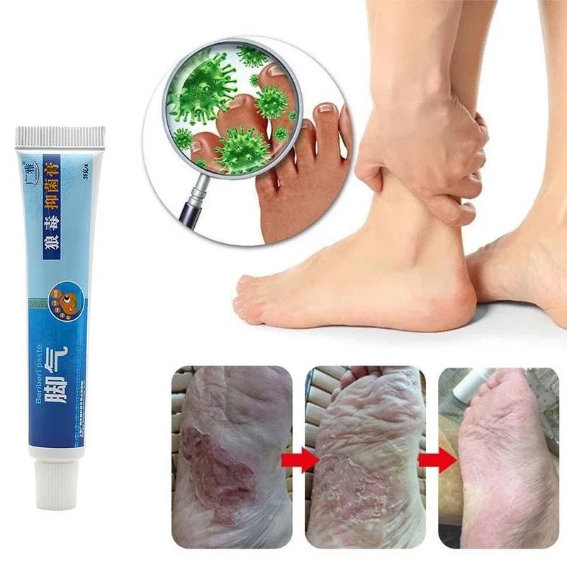 Антибактериальный крем для ног Athlete 20 г средство ухода за кожей от грибков