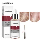 Сыворотка LANBENA для восстановления ногтей, антигрибковое средство для ногтей, удаление онихомикоза, питание, осветление рук, ног, уход за ногтями