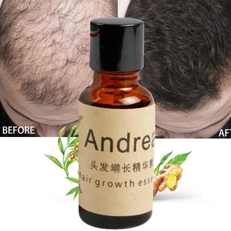 Hot Sale 20ml Essential Oils Herbal Keratin Fast Hair Growth Essence Loss Liquid Ginger Dense Fast Grow Restoration Hair Care
Hot Sale 20ml Essential Oils Herbal Keratin Fast Hair Growth Essence Loss Liquid Ginger Dense Fast Grow Restoration Hair Care