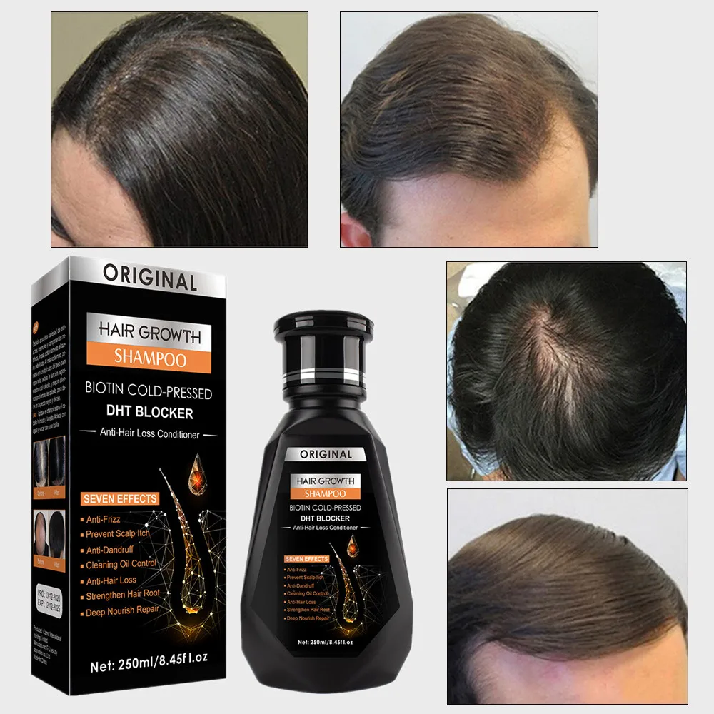 

250ml Help Hair Grow Quickly Esential Oil Shampoo Treatment Hair Loss Clean Scalp Repair Hair Follicles Thick Health Hair Care