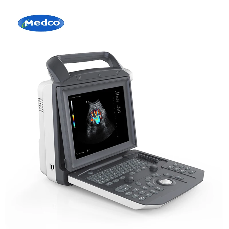 

Portable Full Digital Color Doppler Ultrasound Machine Medical Scanner Ultrasound