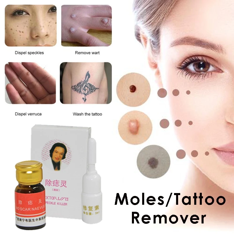 

Skin Tag Remover Solution Painless No Trace Mole Skin Dark Spot Removal Face Wart Tag Freckle Removal Cream Oil Plaster