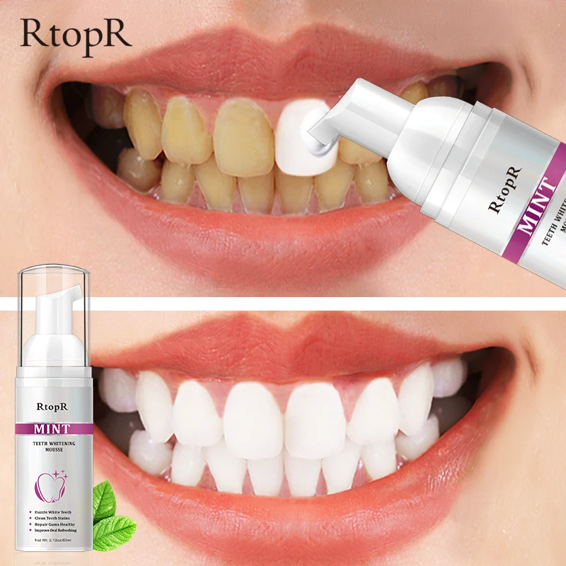 

RtopR Teeth Whitening Remove Smoke Stains Coffee Stains Fresh Breath Bad Breath Clean Teeth Stains Dazzle White Teeth 60ml