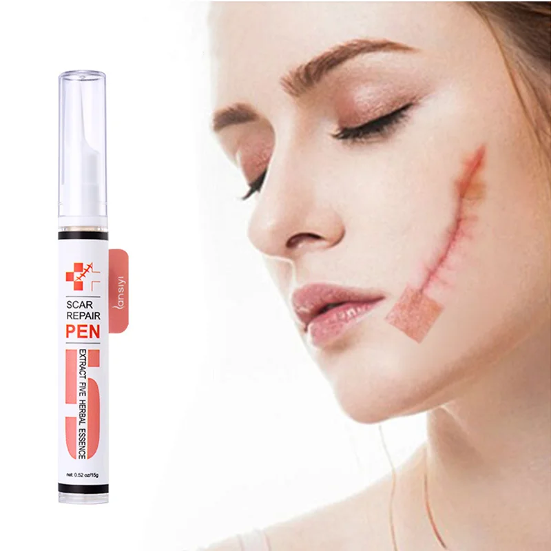 

15g New Scar Cream Herbal Essence Dilutes Scar Pen Repair Treatment Acne Marks Moisturizing Gel Whitening Facial Skin Care