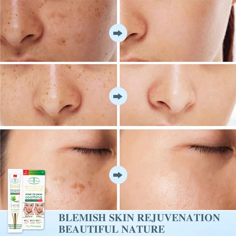

Acne Scar Removal Cream Stretch Marks Face Gel Remove Acne Effective Whitening Freckle Cream Remove Melasma Spot Pigment Melanin