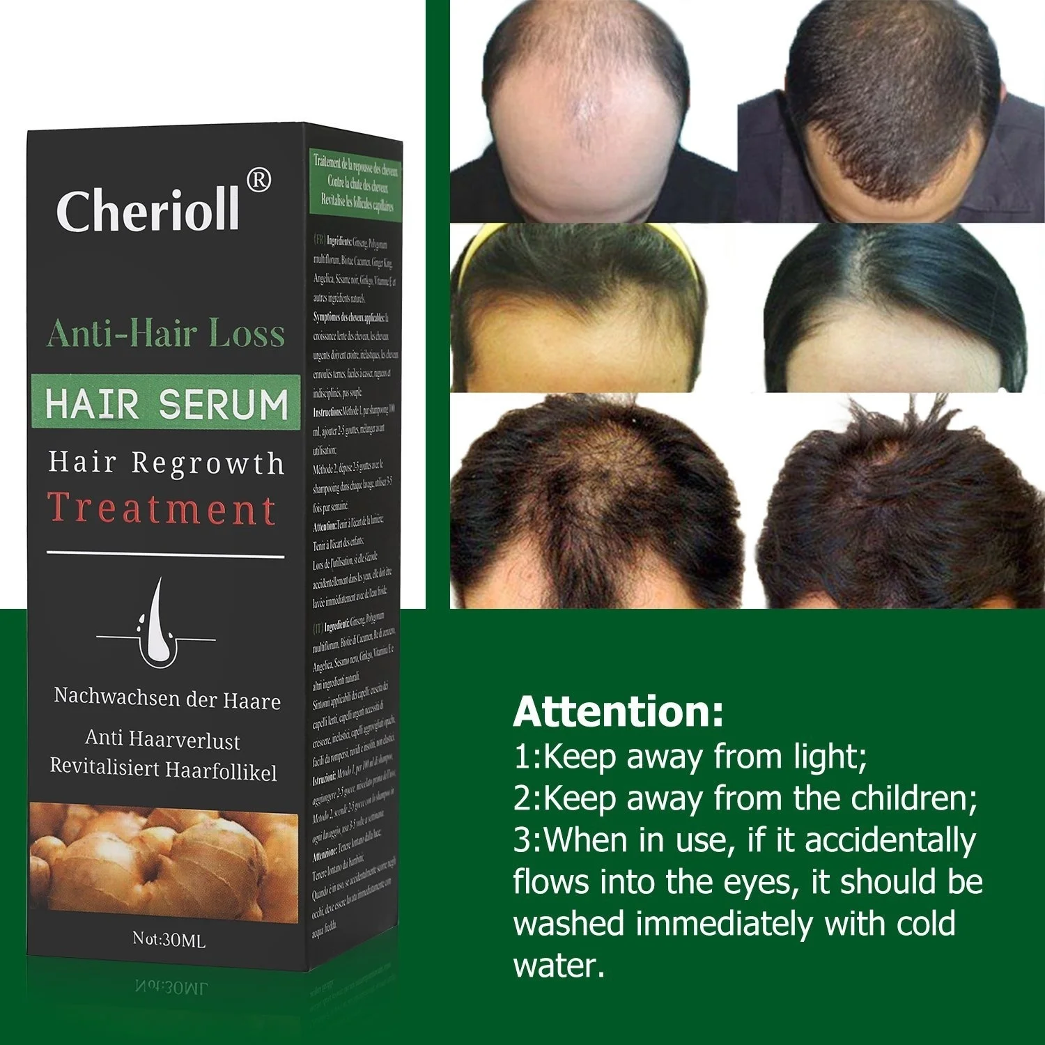 Сыворотка от выпадения волос и истончение сыворотка для стимулирует новый рост