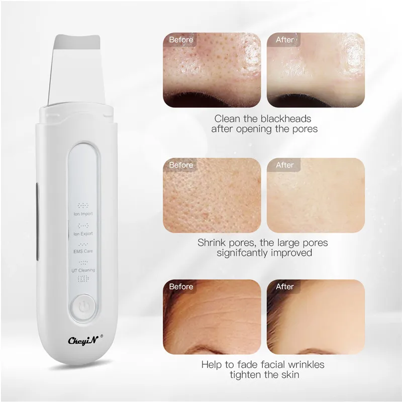 Ультразвуковой ионный скребок для кожи вибрирующий массажер лица очиститель пор