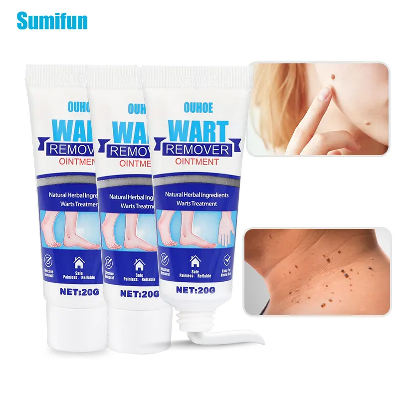

1/2pcs Warts Removal Cream For Treat Tags Mole Antibacterial Ointment Painless Remove Wart Foot Corn Ointment Health Care Beauty