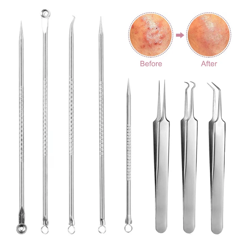 1 шт. пинцет для удаления чёрных точек на лице|Устройство ухода за кожей лица| |