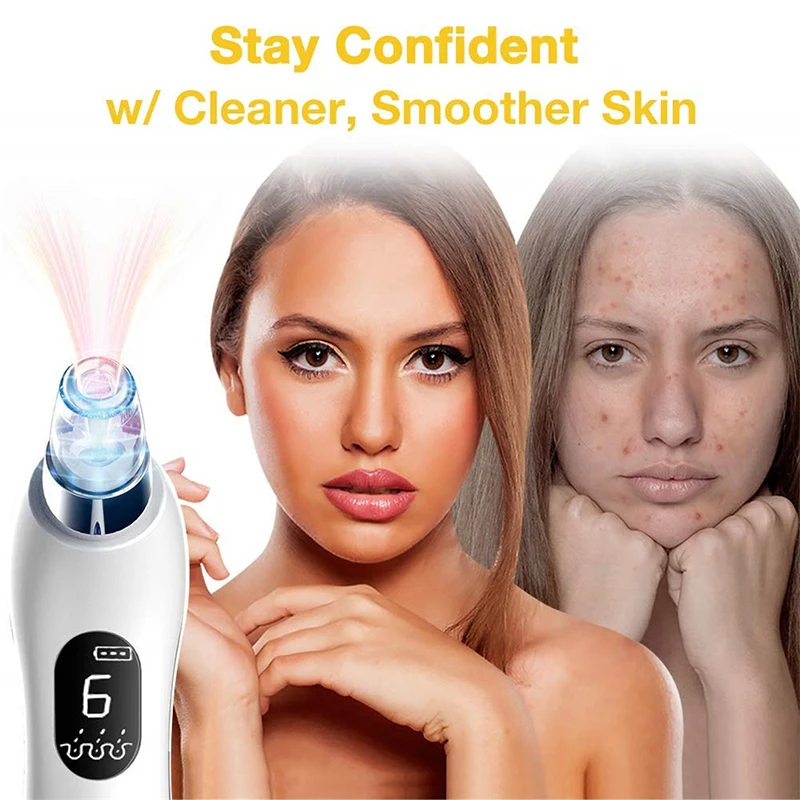 Электрический вакуумный пылесос для очистки лица удаление черных точек машина