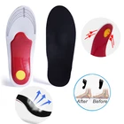 Ортопедические Стельки Arch подушка для поддержки, стельки для обуви, от плоскостопия, ортопедические стельки, супинаторы для женщин и мужчин, стельки с гелевой подкладкой
