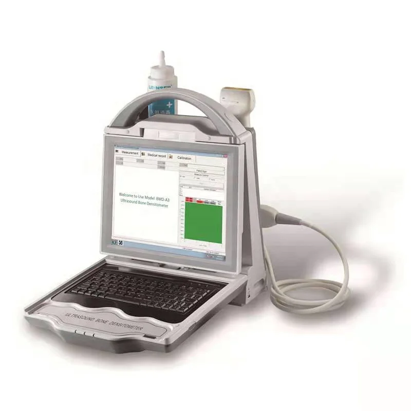 

Factory Price Medical Ultrasonic Bone Density Tester Ultrasound Machine