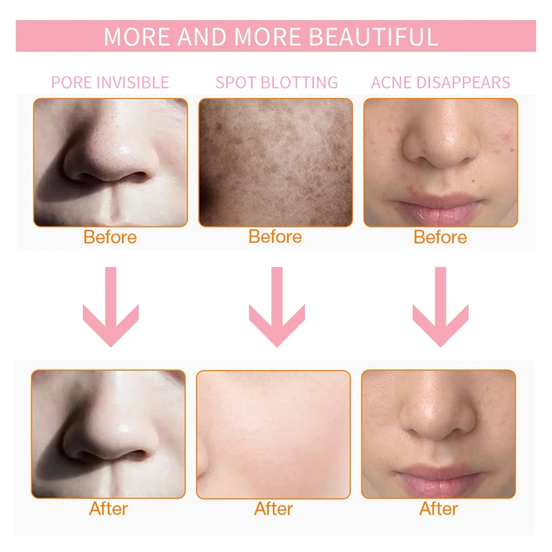 Светодиодный светильник фотонная терапевтическая маска 7 цветов лечение