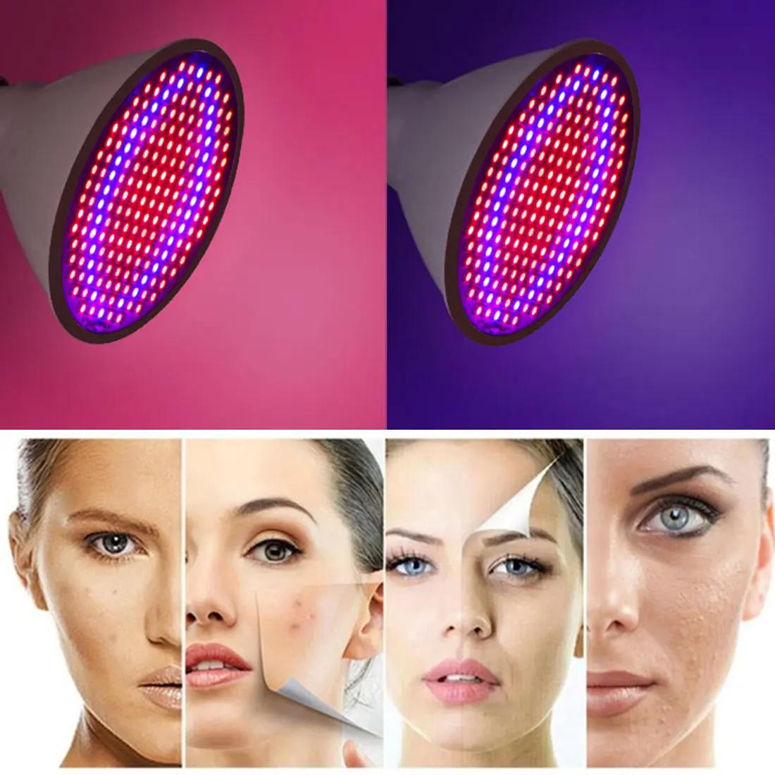 

7W 20W LED Lights Skin Rejuvenation Light Professional Therapy Acne Wrinkle Removal Face Body Beauty Salon Skin Care Tool