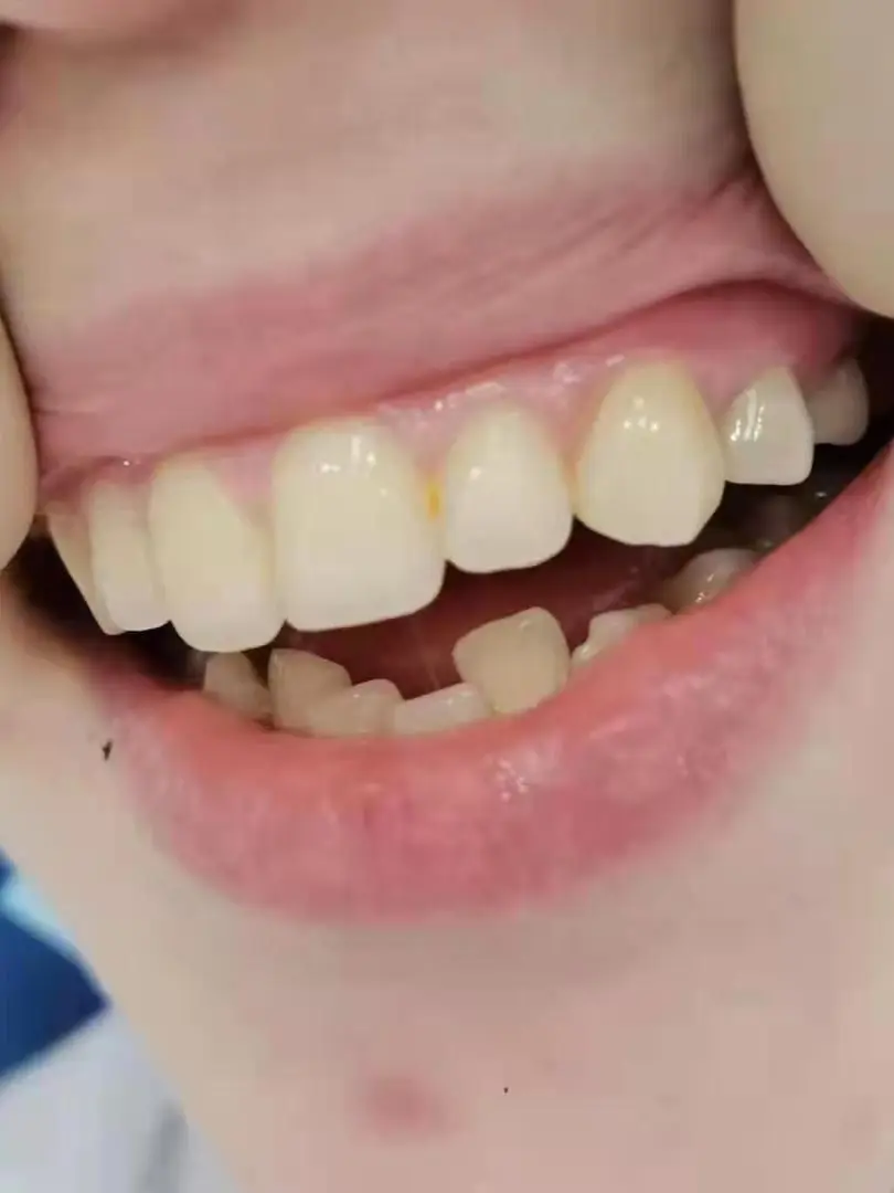 Высокое качество CE/ISO Dental 3D Pro многослойный циркониевый блок прозрачный 43-57% |