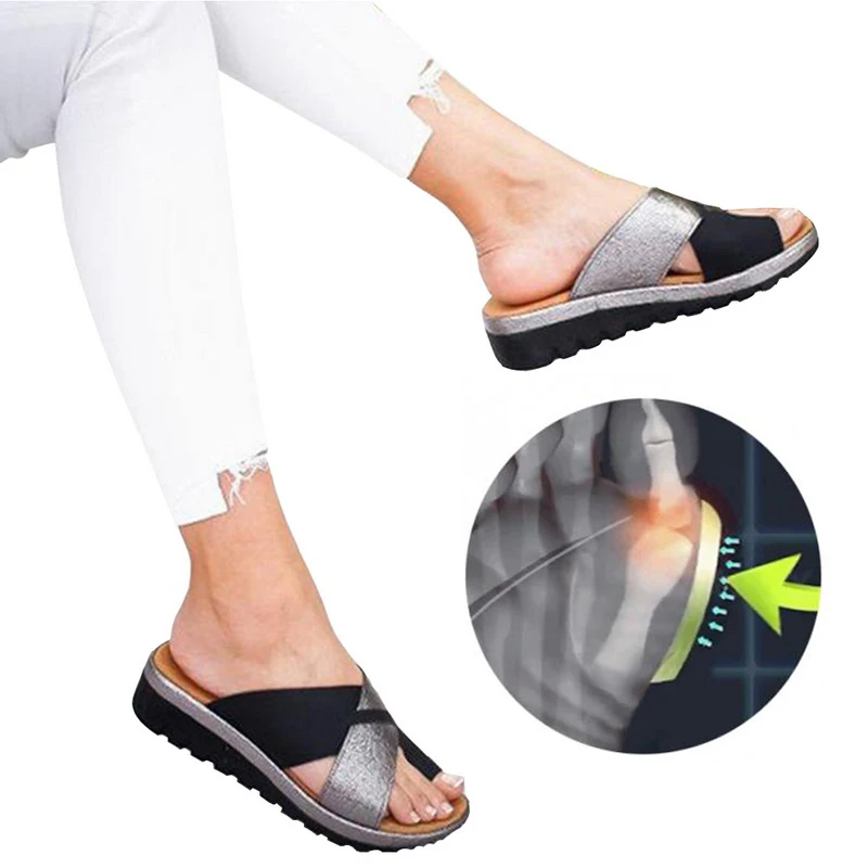 

2020 Women Shoes Slippers Orthopedic Bunion Corrector Comfy Platform Ladies Casual Big Toe Correction Sandal Sandalias De Mujer