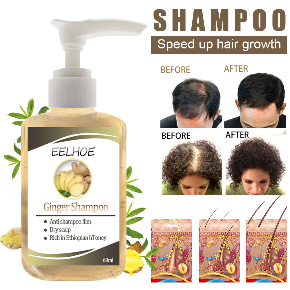 Шампунь для волос имбирь предотвращает выпадение ускоряет рост жидкий Уход за