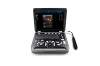 contec cms1700b portable laptop ultrasound scanner color doppler cardiac probe machine