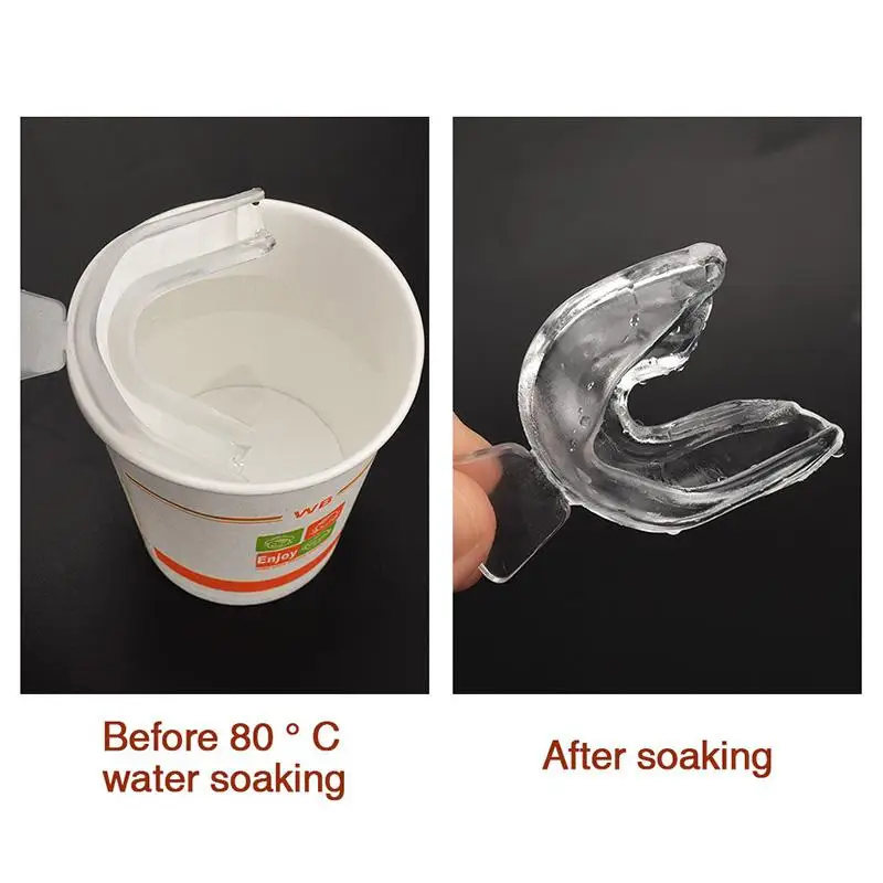 5 шт. одноразовые прозрачные отбеливающие зубные скобы|Отбеливание зубов| |