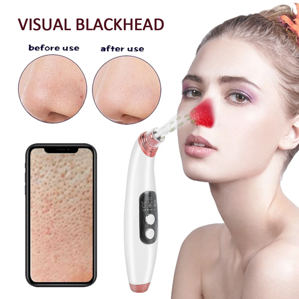 

Electric Blackhead Remover Pore Vacuum Facial Acne Suction Vaccumm Removal Extractor Black Head Remover Facial Cleaning Tool