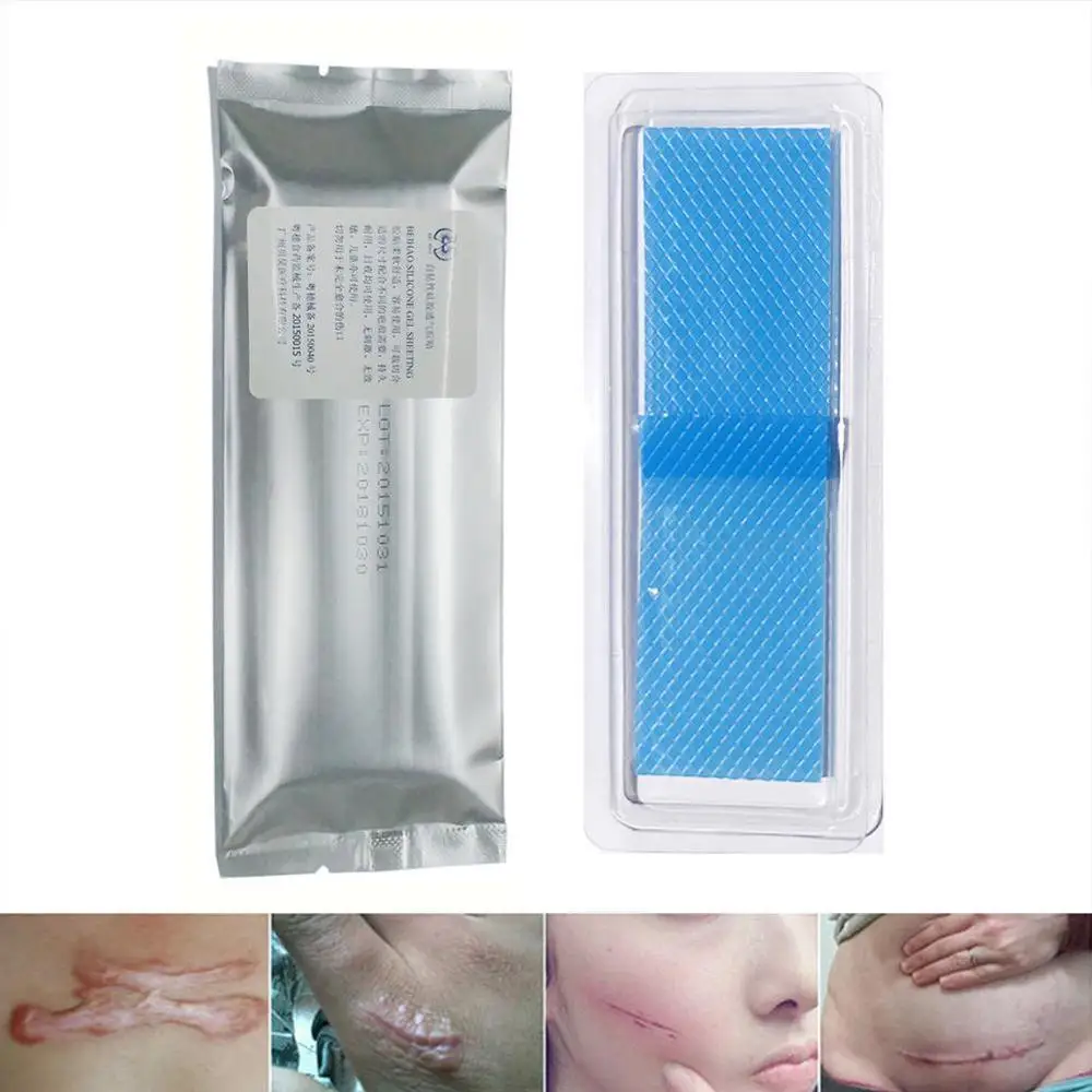 

Silicone Removal Patch Reusable Acne Gel Scar Therapy Trauma Repair Patch Sheet Silicon Burn Skin Remove R9L7