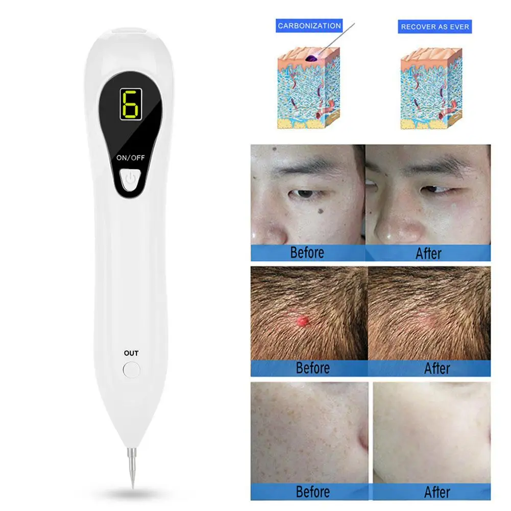 Meizu Pro 6 уровня ЖК-дисплей кожи бородавки пятна веснушки Удаление родинок Ручка