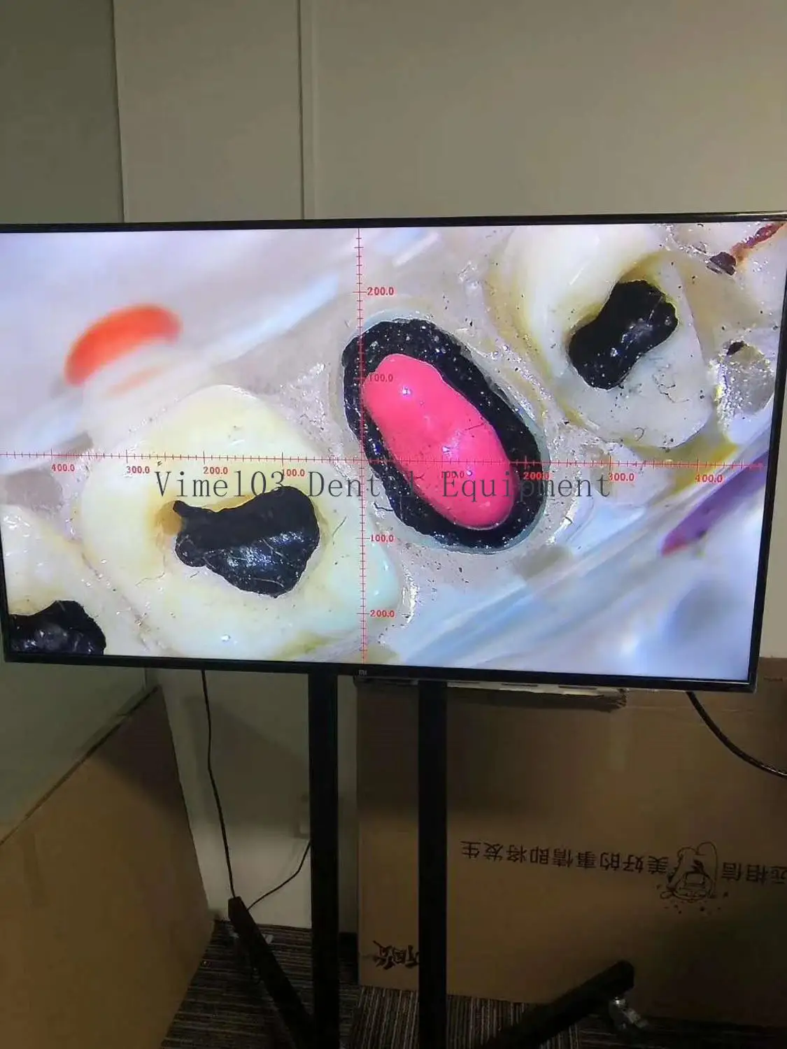 Стоматологический цифровой USB-микроскоп с тележкой | Красота и здоровье