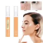 Крем для удаления веснушек и черных точек, TSLM1