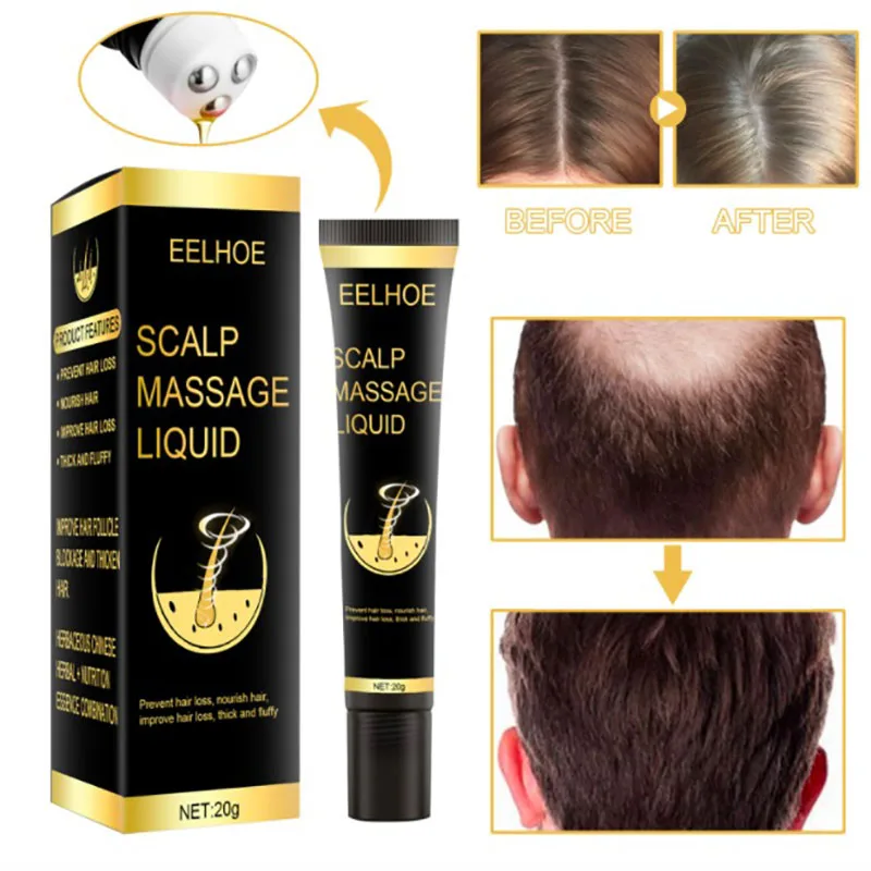 

7 Days Organic Hair Loss Growth Oil Serum Keratin Product Anti Chute Pousse Repousse Cheveux Cabelo Organico Liso Porost Włosów