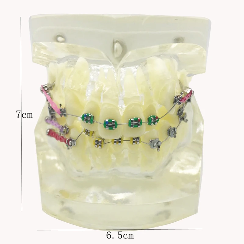 Wrong jaw correction tooth model M3005/Dental Orthodontic teeth model/Fault Correction Tooth model With ligature