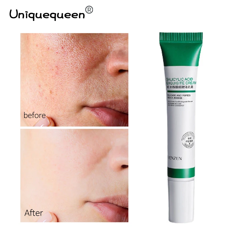 

Крем для лица с салициловой кислотой, восстанавливающий поры, Сужающий поры, укрепляющий кожу, увлажняющий, подтягивающий экстракт, отбелив...